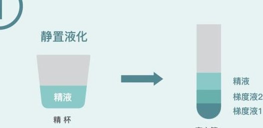 美国试管生殖有哪些优势，附美国试管生殖的流程
